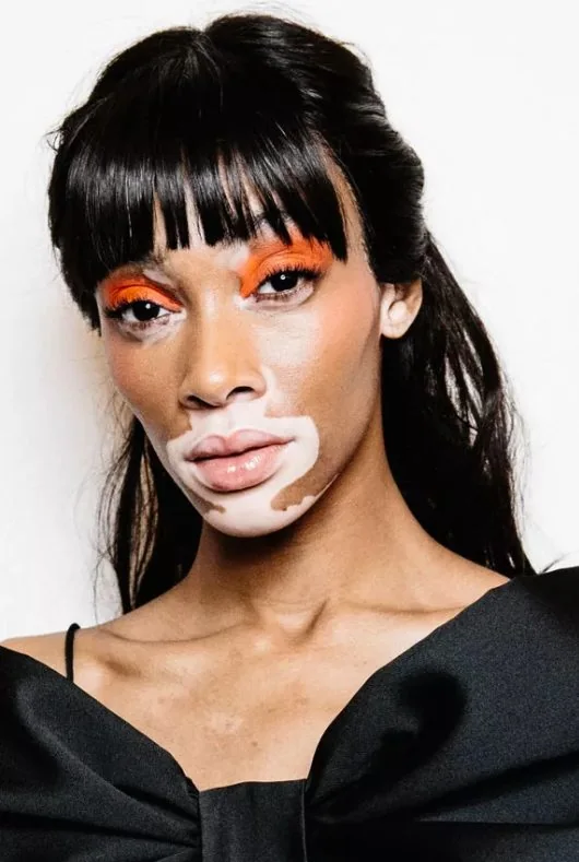 Winnie Harlow's blunt bangs gradually shorten at the center of her face, highlighting her eyes.